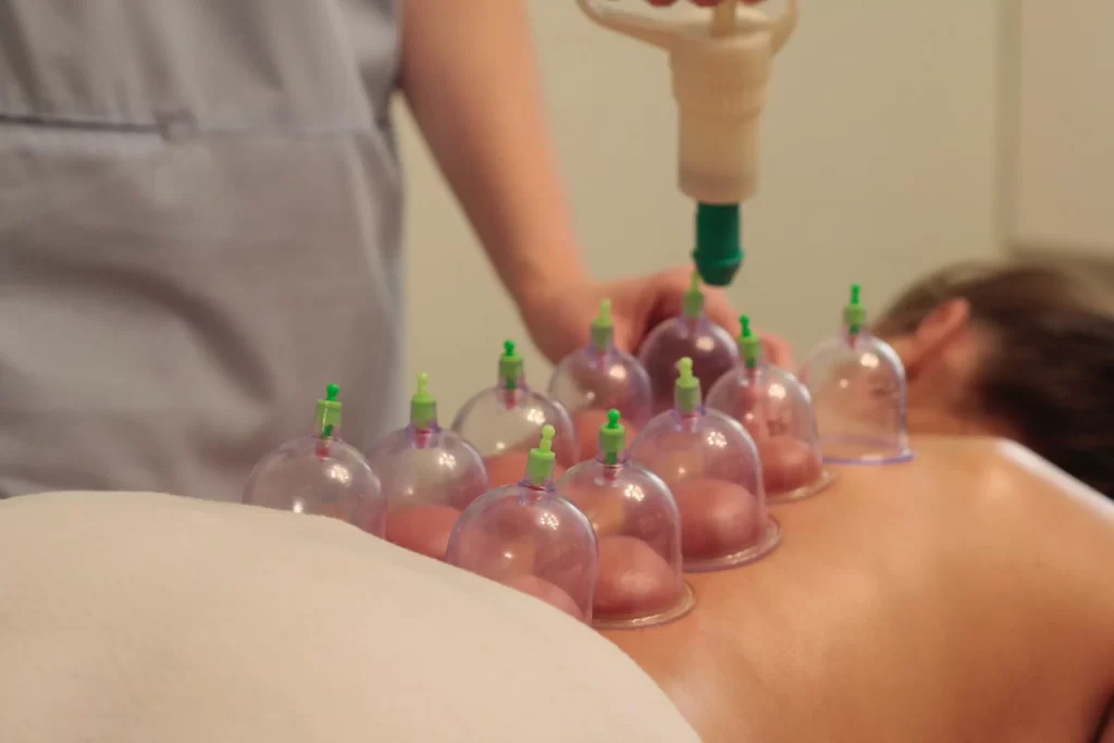 cupping therapy near me