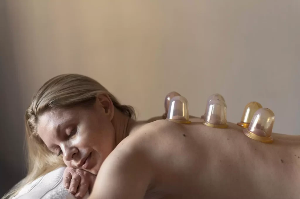 new orleans cupping therapy