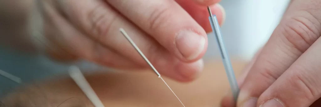 top new orleans acupuncture